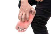خارش کف پا نشانه کدام بیماری است؟