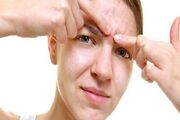 دلایل شایع خارش مداوم پیشانی