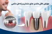 عوارض خالی ماندن جای دندان /چرا ایمپلنت مهم است