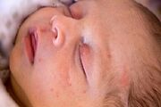 ارائه خدمات تخصصی رایگان به ۵۷ بیمار مبتلا به فنیل‌کتونوری در یزد