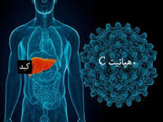 هشدار نسبت به ابعاد خاموش هپاتیت C؛ راه‌های انتقال و ضرورت تشخیص زودهنگام