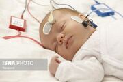 غربالگری شنوایی نزدیک به ۵۰۰۰ نوزاد زنجانی در نیمه نخست امسال
