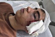 مصدومیت شدید دانش‌آموز توسط معلم در دهبکری بم