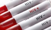 بیشترین شیوع HIV در چه بازه سنی است؟