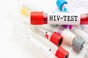 آمار مبتلایان به ایدز : هشدار درباره تغییر الگوی انتقال HIV