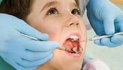 فقط ۴۰ درصد کودکان ۱۲ ساله فاقد پوسیدگی دندان هستند