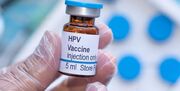 توضیح معاون وزیر بهداشت درباره دلایل افزایش آمار HPV در کشور/ استخرها می‌توانند عامل شیوع ویروس HPV باشند؟