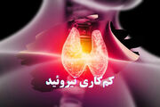 مقاله علمی/ضرورت آگاهی، غربالگری و مدیریت به‌موقع یک اختلال شایع غدد درون‌ریز