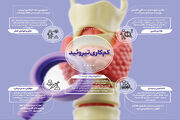 اینفوگرافی | کم‌کاری تیروئید؛ بیماری شایع اما قابل تشخیص و درمان