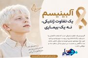 آلبینیسم؛ اختلالی با ریشه‌های ژنتیکی متنوع و پیامدهای گوناگون