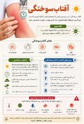 اینفوگرافیک/ آفتاب‌سوختگی و راه‌های پیشگیری ودرمان آن