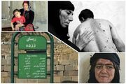 نفس‌های مسموم در هیروشیمای ایران؛ زرده در انتظار التیام زخم‌های کهنه