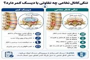 چرا مشکلات ستون فقرات در زنان بیشتر مورد توجه قرار گرفته است؟
