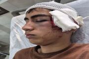 مصدومیت یک دانش‌آموز در پی برخورد فیزیکی معلم در بم