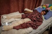 زندگی میان درد و ترس؛ کودکان غزه هزینه حمله‌های مداوم رژیم صهیونیستی را متحمل می‌شوند
