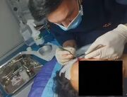 دستگیری پزشک قلابی عمل‌های زیبایی در شهریار تهران
