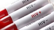 پویش «من هم تست HIV می‌دهم» تا ۲۰ آذر ادامه دارد