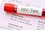 تغییر مسیر HIV در ایران / انتقال جنسی در صدر موارد جدید