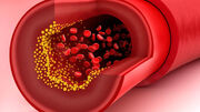 triglycerides چیست ؟ + عملکرد اصلی تری گلیسرید