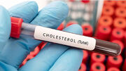 total cholesterol در آزمایش خون چیست؟