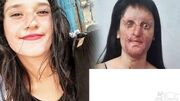 عجیب اما واقعی/ ازدواج دختر صورت سوخته با عامل اسیدپاشی / زیبایی چهره عروس خانم قبل اسید سوختگی را ببینید