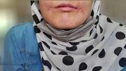 مرد مشهدی لب‌های زن ۱۸ ساله‌اش را دوخت / فائزه به کلانتری پناه برد + عکس