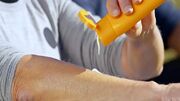ضدآفتاب خوراکی؛ سپر واقعی در برابر آفتاب یا یک ادعای تبلیغاتی؟