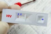 تغییر الگوی شیوع HIV در ایران؛ انتقال جنسی جایگزین اعتیاد تزریقی شد