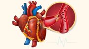 برای پایین آوردن تری گلیسیرید چه بخوریم؟ ۷ انتخاب غذایی مفید