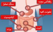 دلیل درد هر قسمت از شکم چیست؟ - روزیاتو