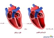 نشانه‌های نارسایی قلبی چیست و راه‌های درمانی آن کدامند؟ | روزنو