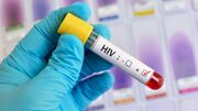 واکنش مقام وزارت بهداشت به محرمانه بودن اطلاعات تست HIV