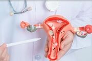 آندومتریوز با چراغ خاموش