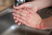 بیماری نادری که بسیاری از آن خبر ندارند