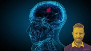 ضربه به سرطان پیش از مقاوم شدن