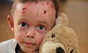 شوق ‌زندگی در پروانه‌ای‌ها