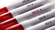 افشای اطلاعات محرمانه بیماران HIV