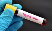 درباره ویروس خطرناک نیپا و شیوع آن در هند چه می‌دانیم؟