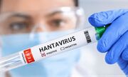 هانتا ویروس مانند کرونا نیست