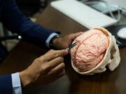 فاز انسانی آزمایش فناورانه ایران در درمان پارکینسون