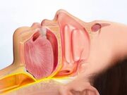 چهره پنهان آپنه خواب در زنان