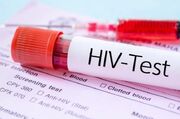 ترس، مهم‌ترین چالش امروز HIV در ایران