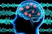 رونمایی چین از MRI نسل جدید؛ گام تازه برای درمان آلزایمر و پارکینسون