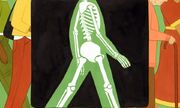 چرا برخی متخصصان خواستار اسکن DEXA زودتر هستند؟
