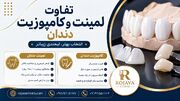 بررسی جامع ۷ تفاوت اصلی لمینت و کامپوزیت دندان به همراه مزایا و معایب