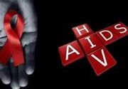 ۷۷ درصد مبتلایان به HIV در فارس تحت درمان قرار دارند