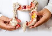 اسهال مزمن در 3 تا 7 درصد افراد شایع است؛ علائم این بیماری چیست؟