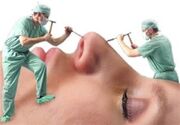 افزایش شکایات از جراحی‌های زیبایی در خراسان جنوبی