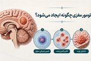 جدیدترین عوامل ایجادکننده تومور مغزی علت تومور مغزی چیست؟