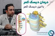 درمان دیسک کمر با لیزر دیسک کمر چگونه است؟
